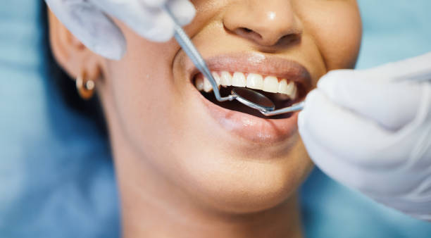 Best Emergency Treatment for Dental Infections or Abscesses in Bel Air, MD
